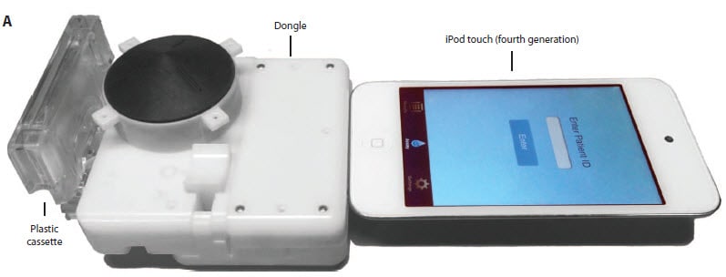 Smartphone's dongle for HIV diagnosis